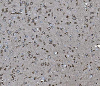 INPPL1 Mouse Monoclonal Antibody