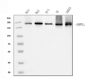 INPPL1 Mouse Monoclonal Antibody