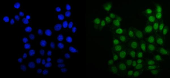 MCM6 Mouse Monoclonal Antibody