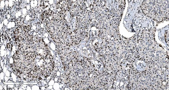 MCM6 Mouse Monoclonal Antibody