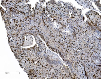 MCM6 Mouse Monoclonal Antibody