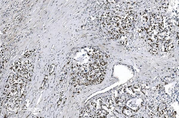 MCM6 Mouse Monoclonal Antibody