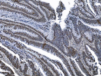 MCM6 Mouse Monoclonal Antibody