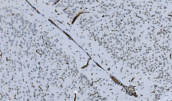 HP1 alpha/CBX5 Mouse Monoclonal Antibody