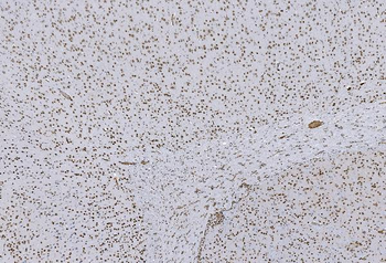 HP1 alpha/CBX5 Mouse Monoclonal Antibody