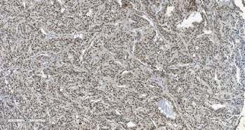 HP1 alpha/CBX5 Mouse Monoclonal Antibody