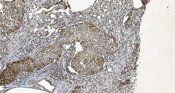 HP1 alpha/CBX5 Mouse Monoclonal Antibody