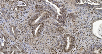 HP1 alpha/CBX5 Mouse Monoclonal Antibody