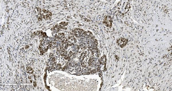 HP1 alpha/CBX5 Mouse Monoclonal Antibody