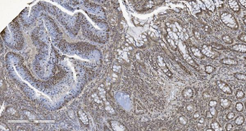 HP1 alpha/CBX5 Mouse Monoclonal Antibody