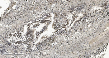 HP1 alpha/CBX5 Mouse Monoclonal Antibody