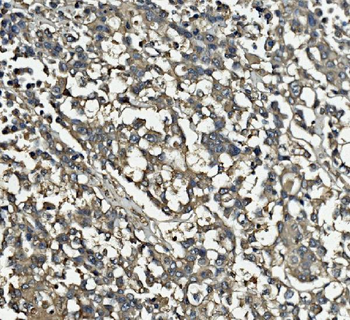 Clathrin heavy chain/CLTC Mouse Monoclonal Antibody