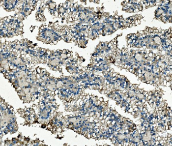 Clathrin heavy chain/CLTC Mouse Monoclonal Antibody