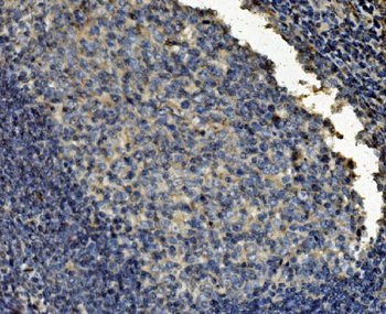 Clathrin heavy chain/CLTC Mouse Monoclonal Antibody