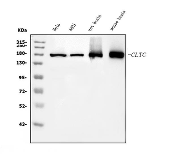 Clathrin heavy chain/CLTC Mouse Monoclonal Antibody
