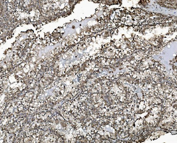 REA/PHB2 Mouse Monoclonal Antibody