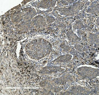 Integrin beta 5/ITGB5 Mouse Monoclonal Antibody