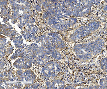 Integrin beta 5/ITGB5 Mouse Monoclonal Antibody