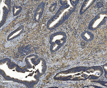 Integrin beta 5/ITGB5 Mouse Monoclonal Antibody