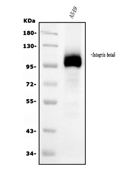 Integrin beta 5/ITGB5 Mouse Monoclonal Antibody