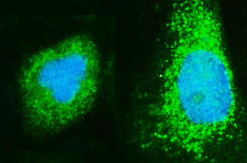 ARF6 Rabbit Polyclonal Antibody