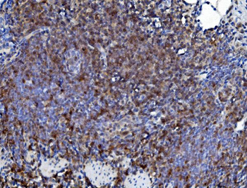 CD226 Rabbit Polyclonal Antibody