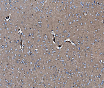EHD3 Rabbit Polyclonal Antibody