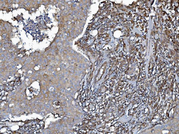 EHD3 Rabbit Polyclonal Antibody