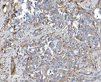 EHD3 Rabbit Polyclonal Antibody
