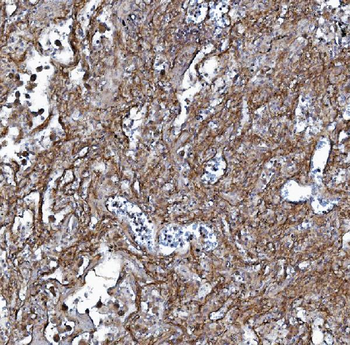 EHD3 Rabbit Polyclonal Antibody