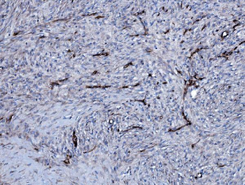 EHD3 Rabbit Polyclonal Antibody