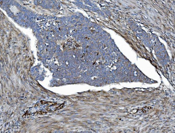 EHD3 Rabbit Polyclonal Antibody