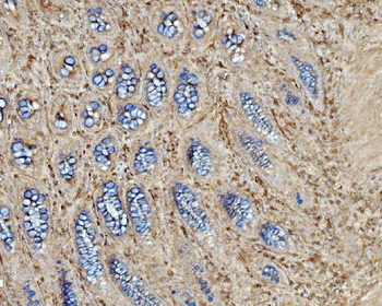 EHD3 Rabbit Polyclonal Antibody