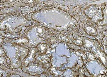 EHD3 Rabbit Polyclonal Antibody