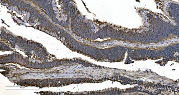 EPRS1/PARS Rabbit Polyclonal Antibody