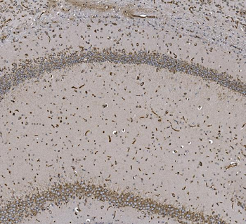 EPRS1/PARS Rabbit Polyclonal Antibody