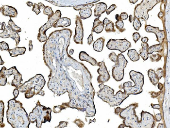 PDIA5 Rabbit Polyclonal Antibody