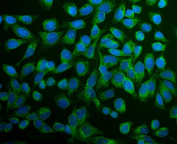 PDIA6 Rabbit Polyclonal Antibody