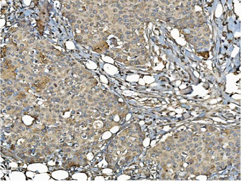 PDIA6 Rabbit Polyclonal Antibody