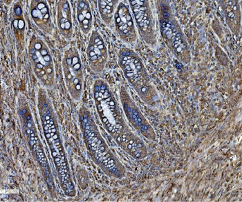 PDIA6 Rabbit Polyclonal Antibody
