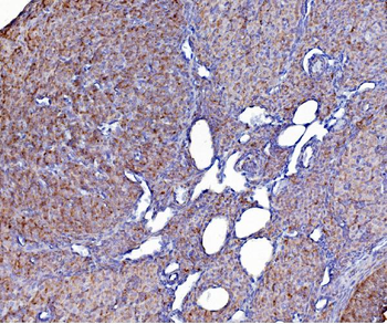 PDIA6 Rabbit Polyclonal Antibody