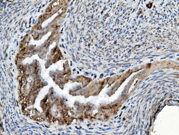 PDIA6 Rabbit Polyclonal Antibody