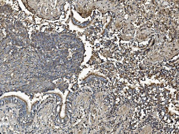Prohibitin/PHB Rabbit Polyclonal Antibody