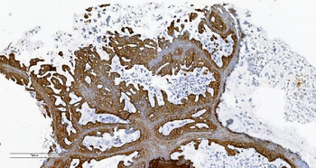 PLTP Rabbit Polyclonal Antibody