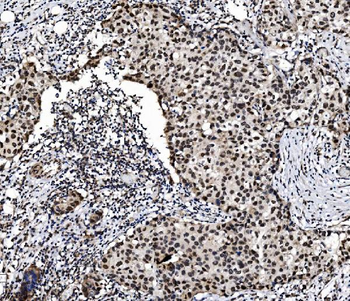PRDM14 Rabbit Polyclonal Antibody