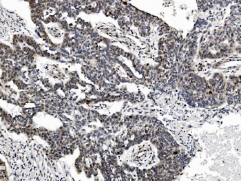 PRDM14 Rabbit Polyclonal Antibody