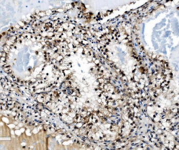 PRDM14 Rabbit Polyclonal Antibody