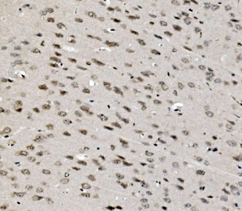 TAF4 Rabbit Polyclonal Antibody