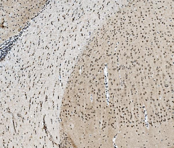 TAF4 Rabbit Polyclonal Antibody