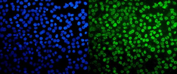 TAF4 Rabbit Polyclonal Antibody